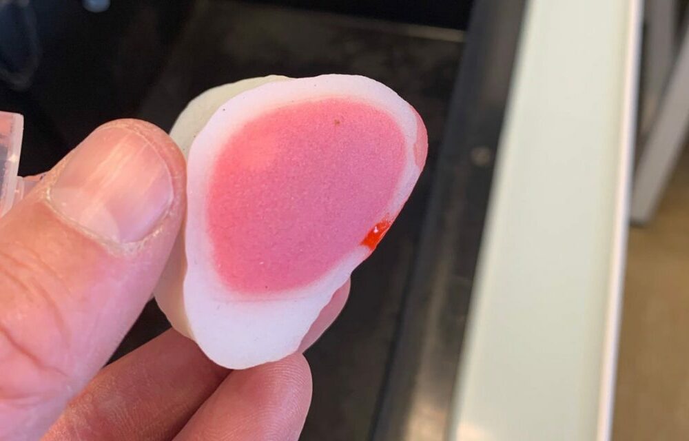 Image French Hospital Improves Surgical Planning with 3D Printing Technology