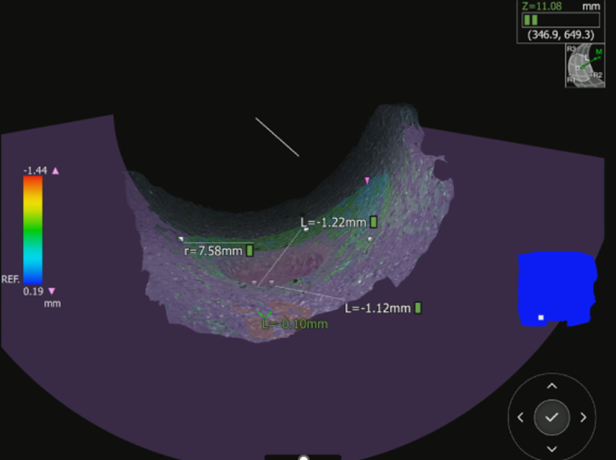 Precision Rvi Mapping System Advanced RVI Tools Help Aviation MRO Teams Keep Pace - DirectIndustry e ...